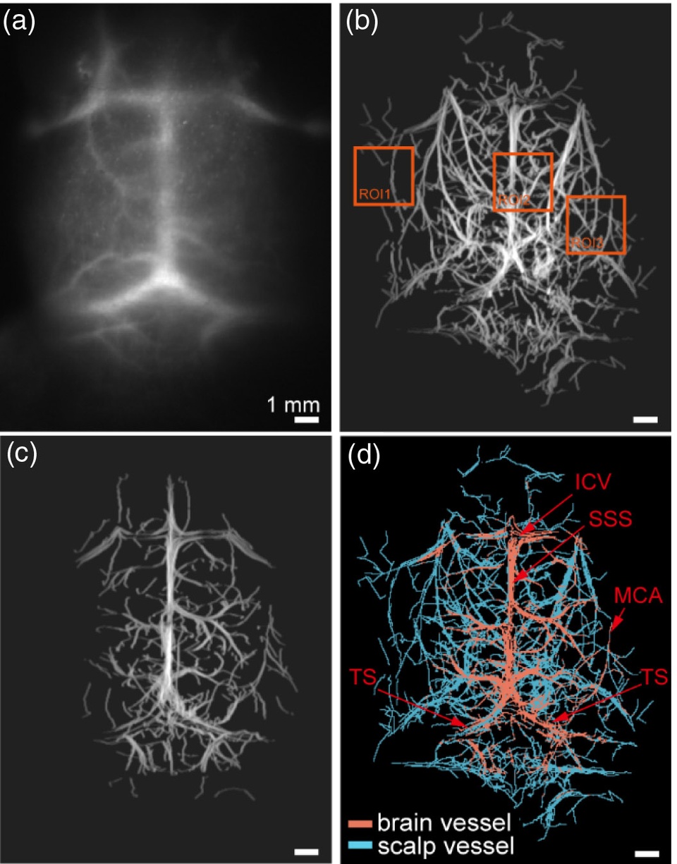 mouse cranium microscopy